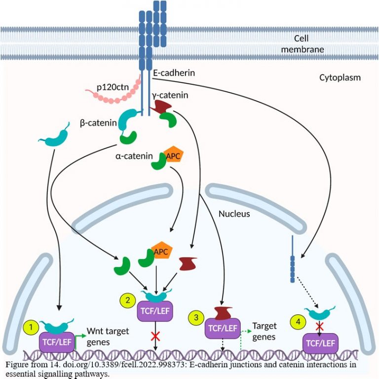 E-cadherin roles in the cell. From Lessey et, al 2022 Reference List item 14. Link to paper: https://www.frontiersin.org/journals/cell-and-developmental-biology/articles/10.3389/fcell.2022.998373/full.